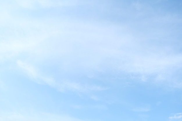 turbo包围有什么区别吗